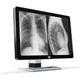 Diagnostic