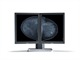 Mammography displays